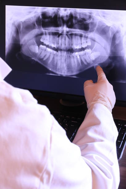 Best Emergency Gum Treatment in Cleveland, AL